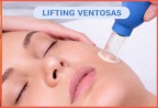 Cursos lifting facial con ventosa Barcelona, cursos masaje facial con ventosas Barcelona
