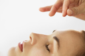 Cursos Lifting Facial  con Acupuntura en Barcelona - España