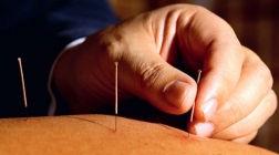 Curso Técnico en Acupuntura Medicina Tradicional China Barcelona España Inicio: Octubre 2023